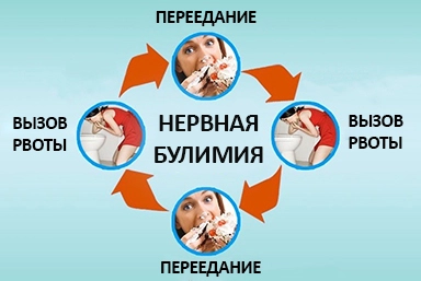 Лечение булимии в Нерюнгри